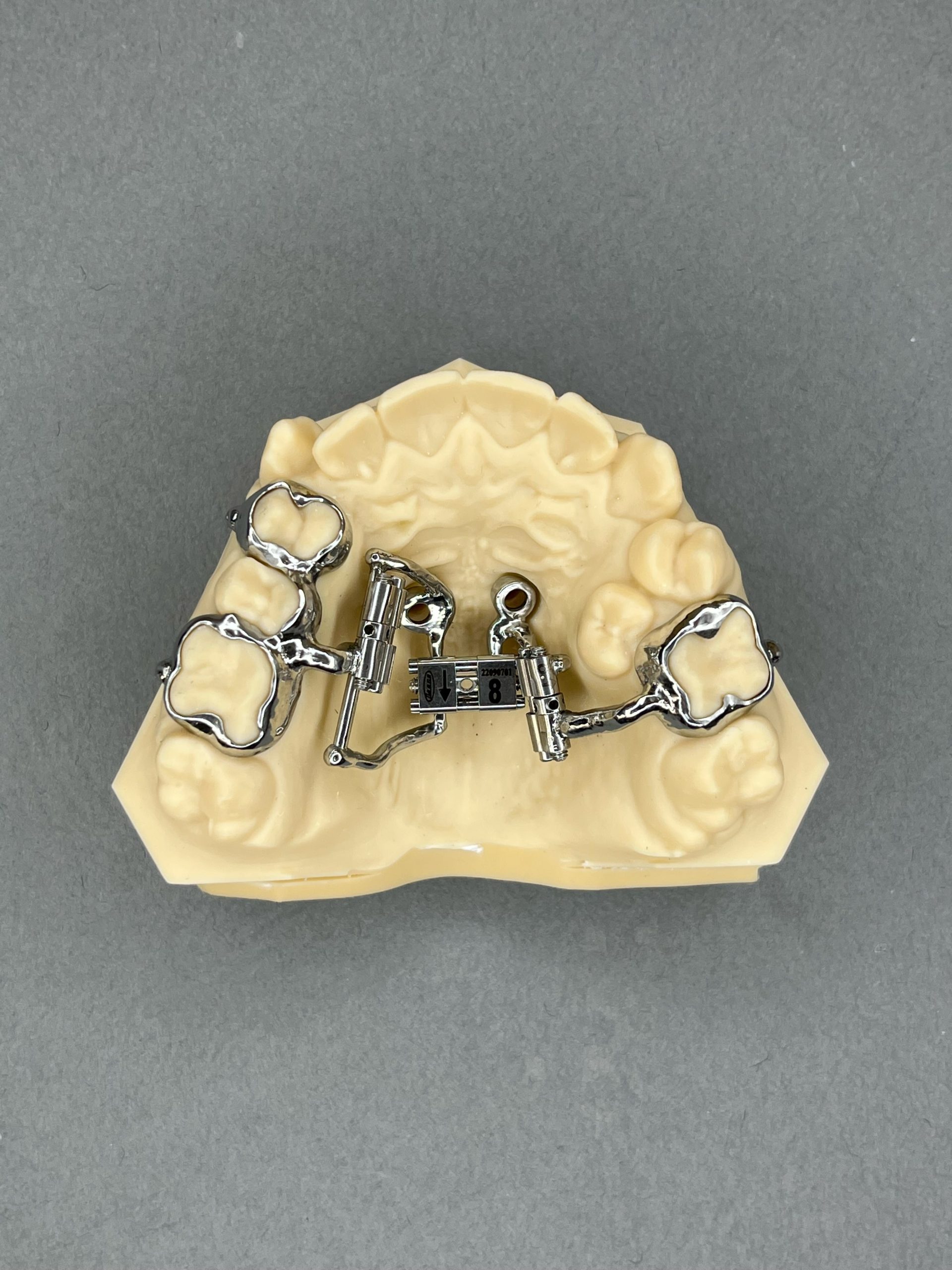 230318-GPA-3D-2MI-Dist-2SR-min
