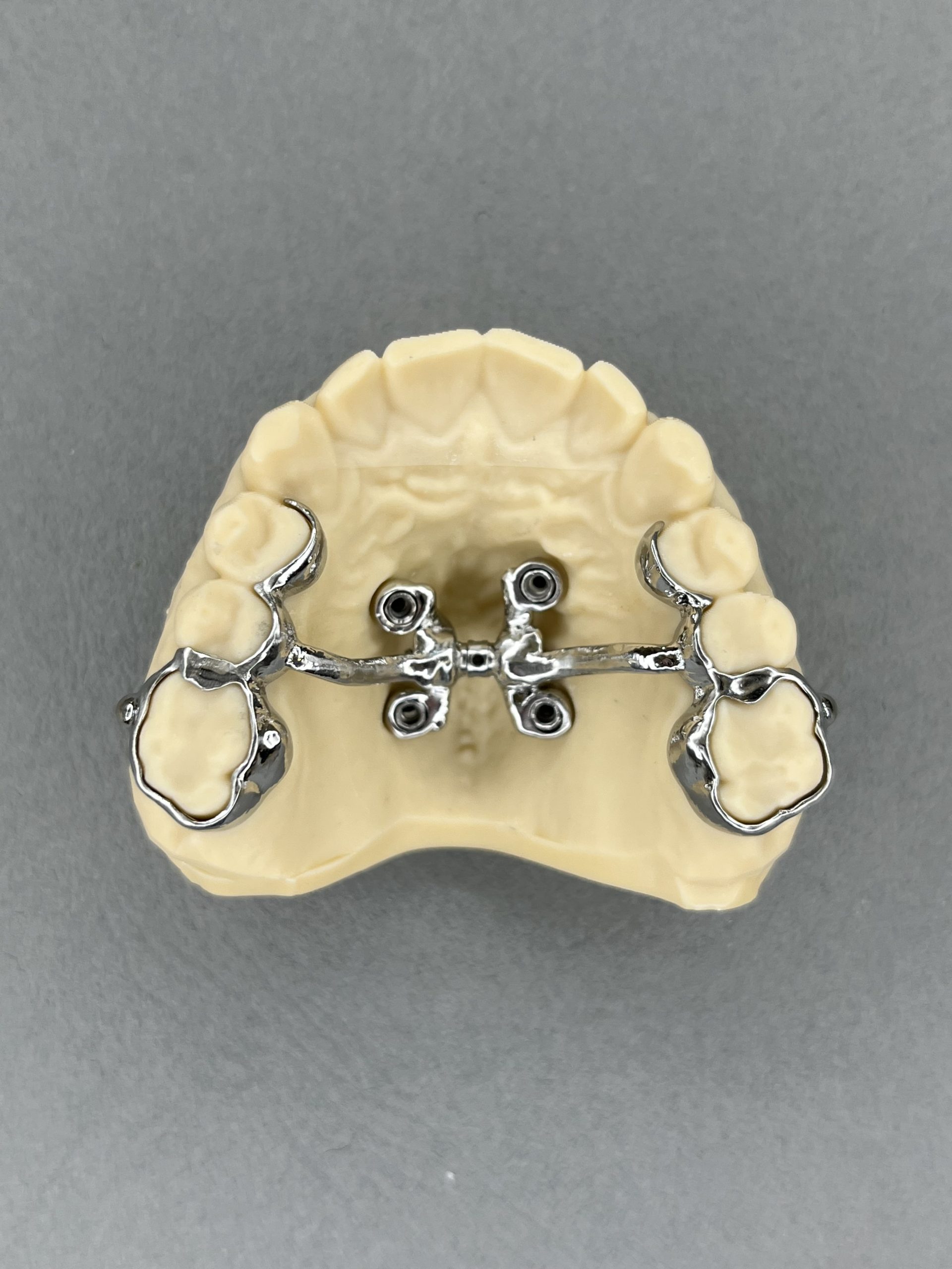 230511-GPA-3D-4MI-siauras-sraigtas-min