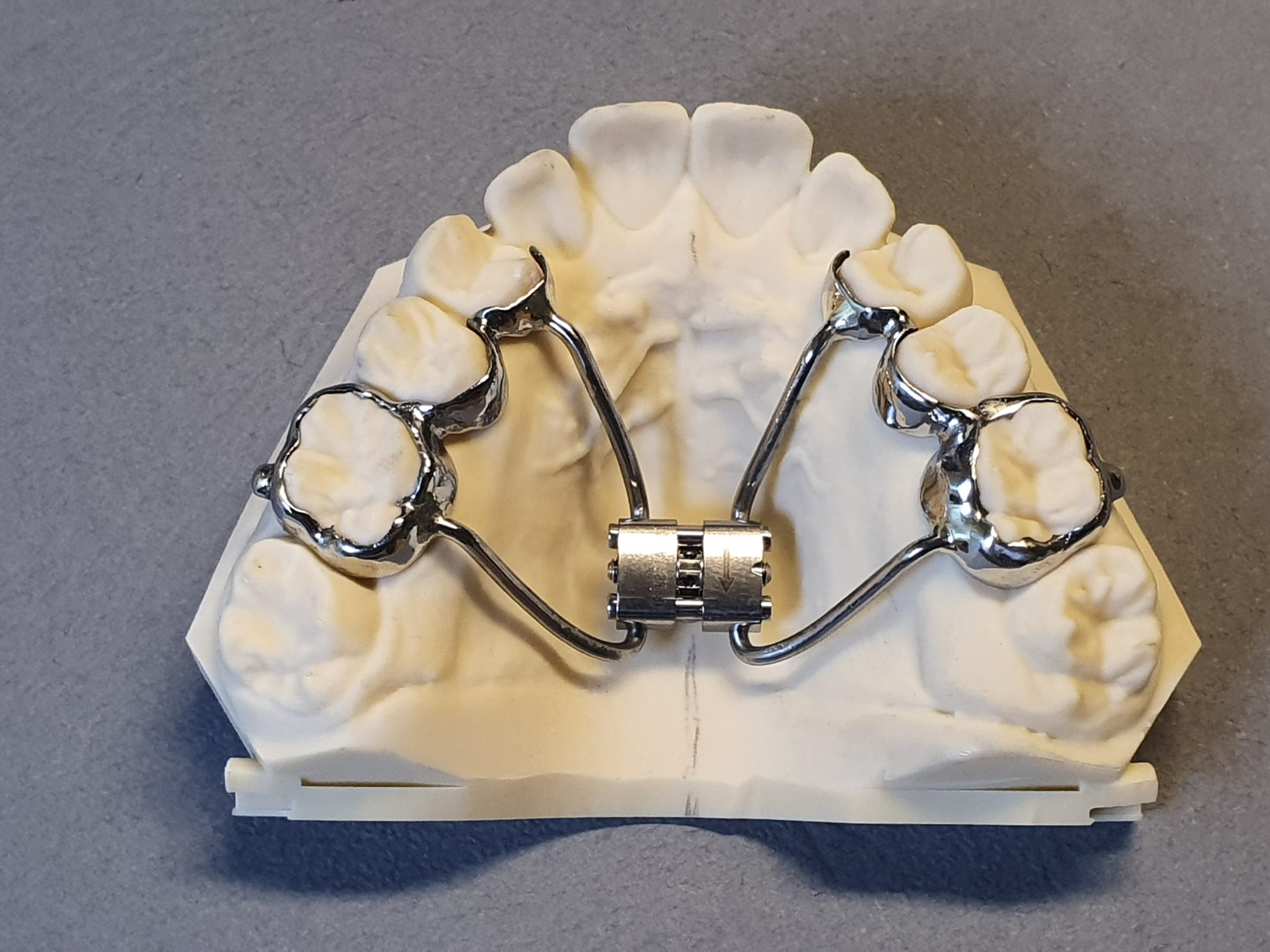 GPA-3D