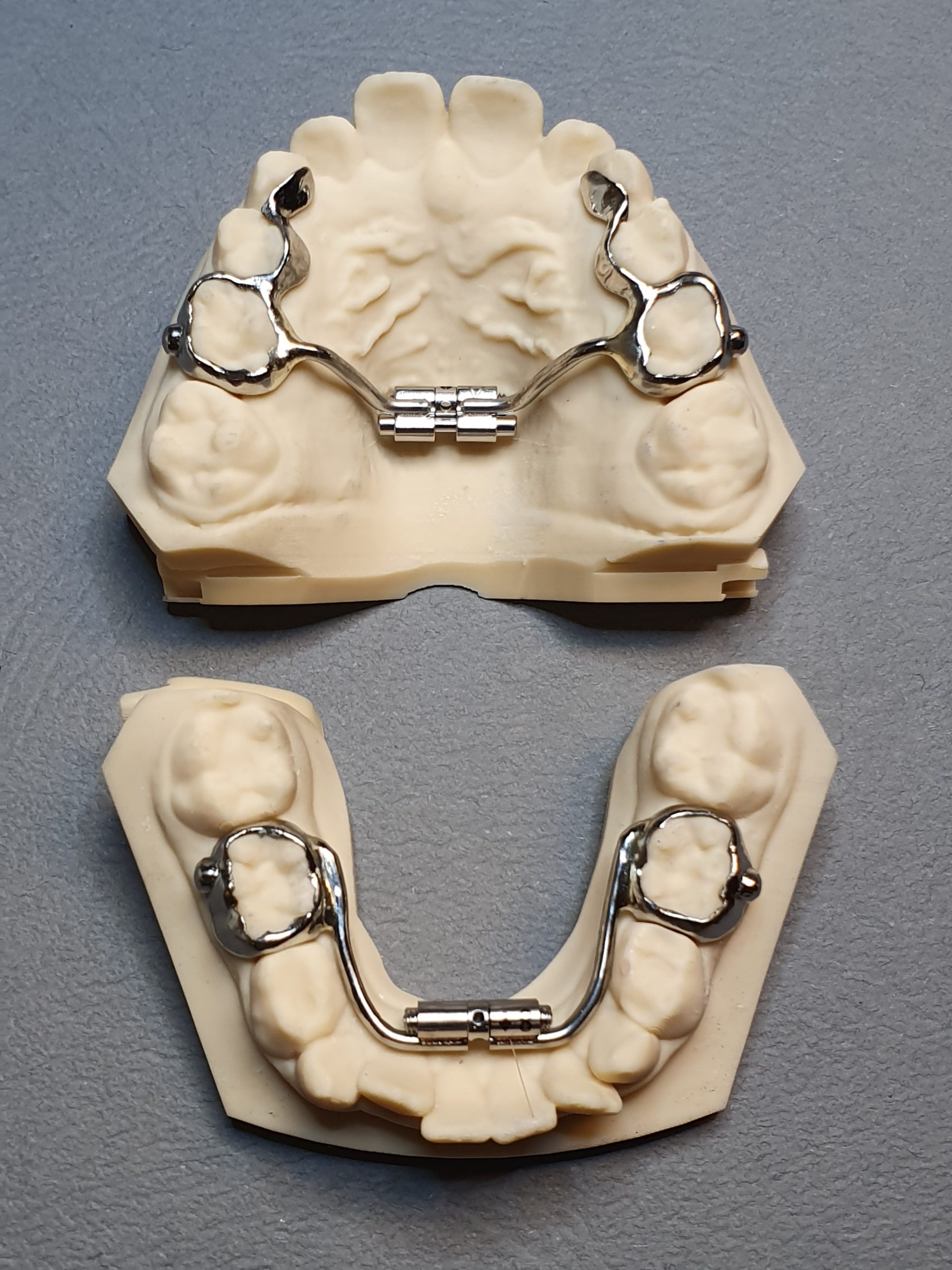 GPA-ant-misraus-sakandzio-min